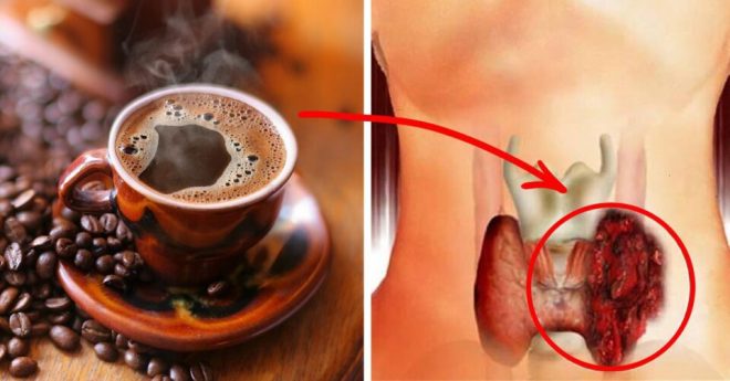 Медики рассказали, какой орган более уязвим при злоупотреблении кофе