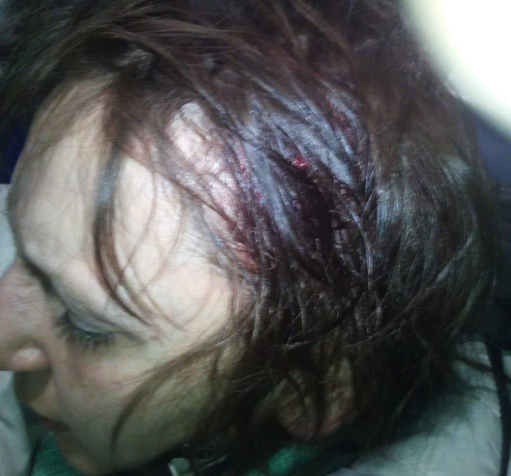 Хулиганы «обстреливали» камнями электричку: пострадала женщина