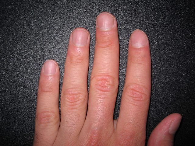Диетологи: Здоровье человека можно определить по состоянию ногтей