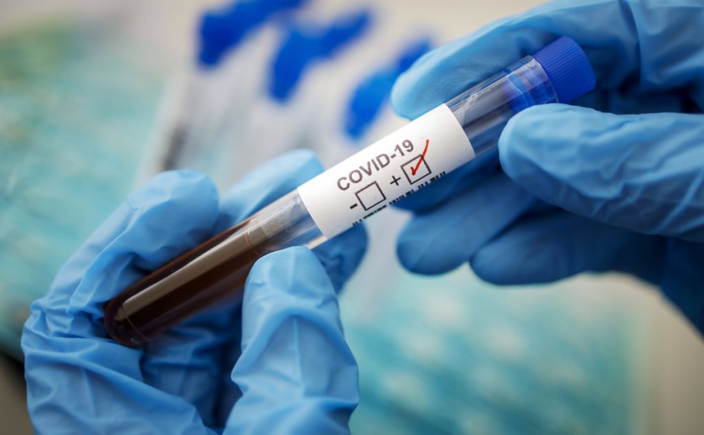 За сутки в Украине подтвердилось 6506 случаев коронавируса
