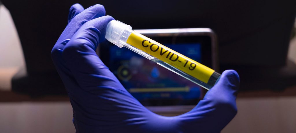 Ляшко: в Украине разрабатывают три вакцины от COVID-19