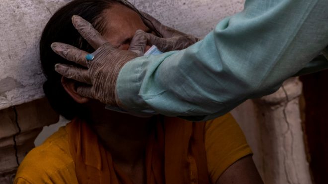 Число больных «черной плесенью» в Индии неуклонно растет