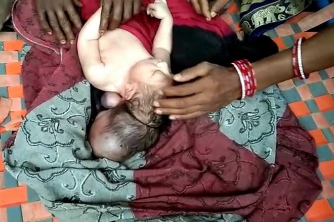 В Индии родился трехглавый младенец: паломники считают его воплощением бога (ФОТО)