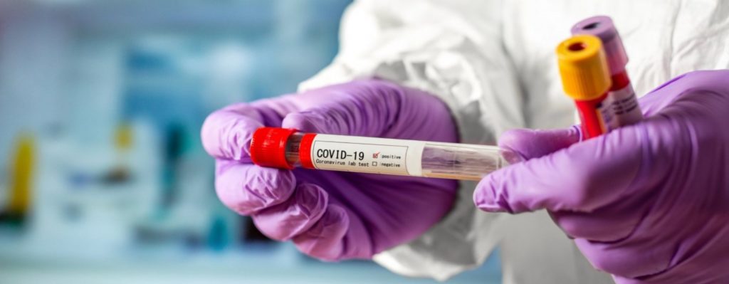 В Украине за сутки обнаружили 598 новых заражений коронавирусом