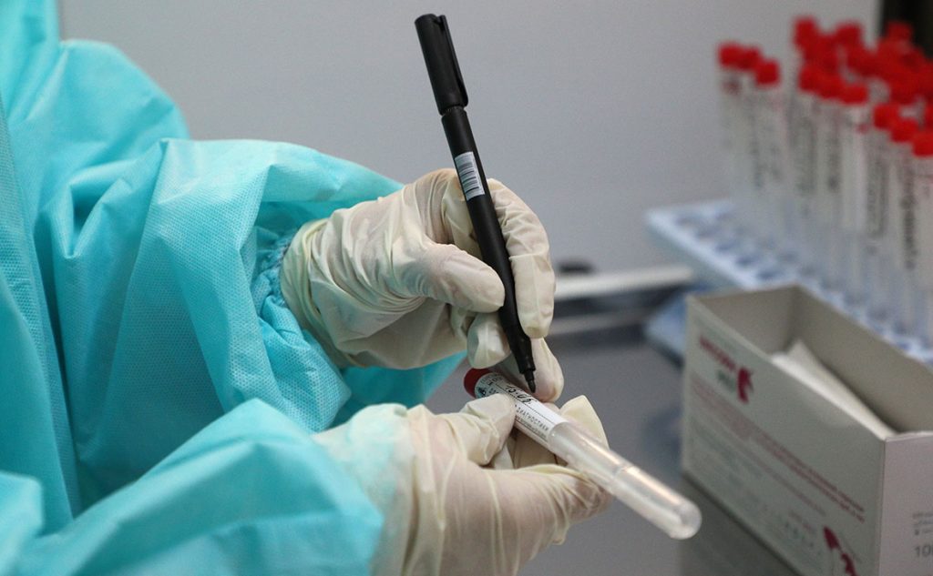 В Украине за сутки выявили 2032 новых случая коронавируса