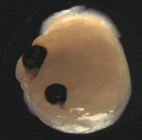 Ученые создали из стволовых клеток мини-мозг и отрастили на нем глаза (ФОТО)
