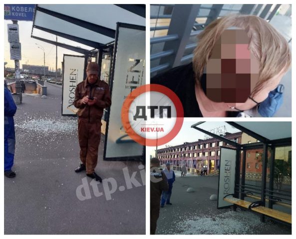 Рядом треснуло стекло: киевлянка получила серьезные травмы на остановке (ФОТО)
