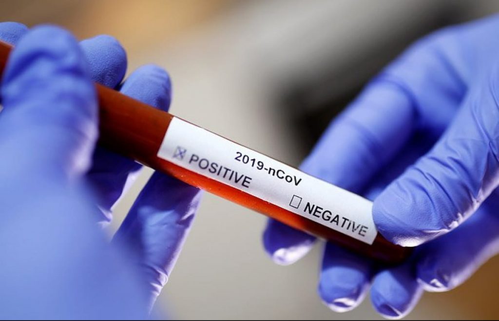 Украина заняла 4 месте в мире по смертности от коронавируса