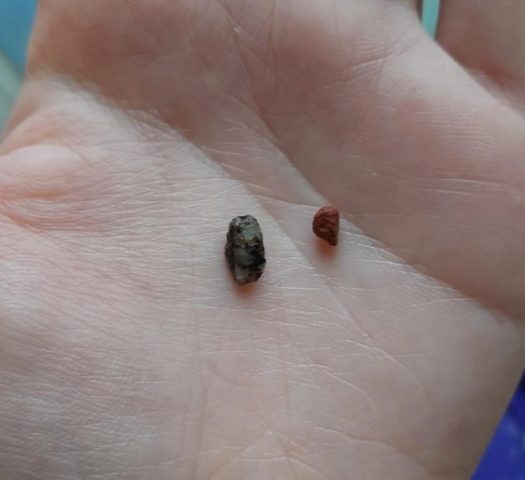 В Мелитополе в фасованном горохе обнаружили камни (ФОТО)