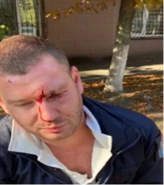 В Киеве жестоко избили парковщика (ФОТО)