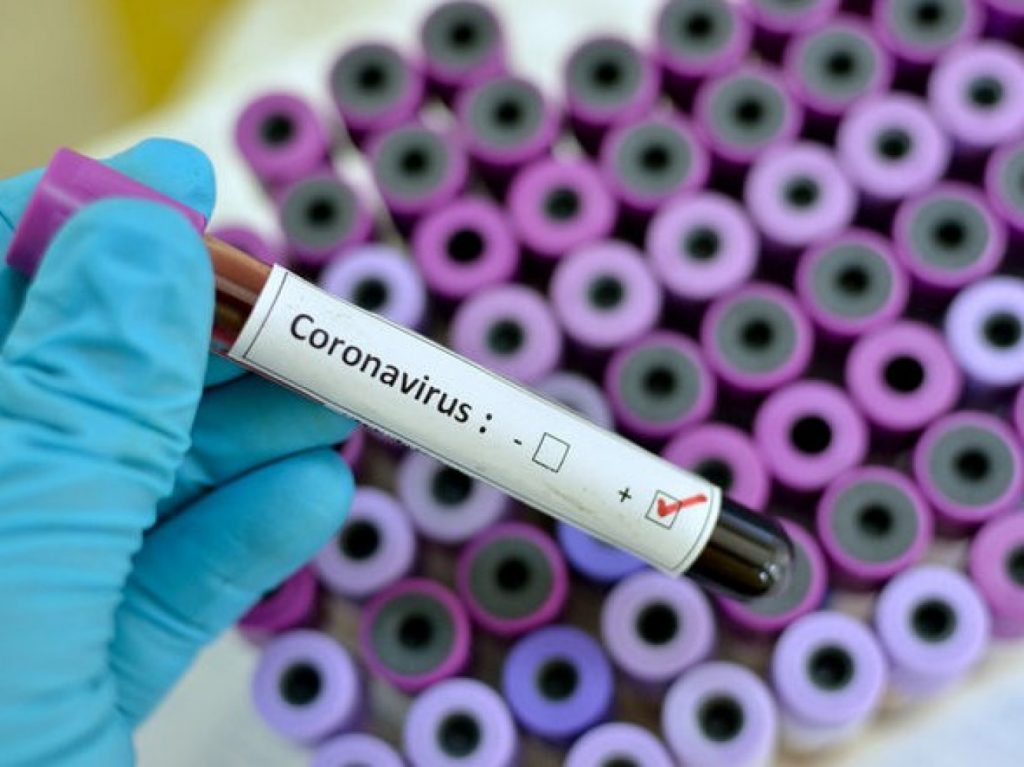 Пик заболеваемости коронавирусом ожидается через  две недели – врач