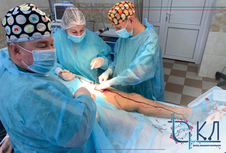 В Черновцах хирурги удалили метровый тромб женщине, переболевшей COVID-19 (ФОТО)