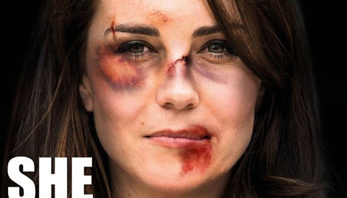 В Европе появилась реклама с избитой Кейт Миддлтон (ФОТО)