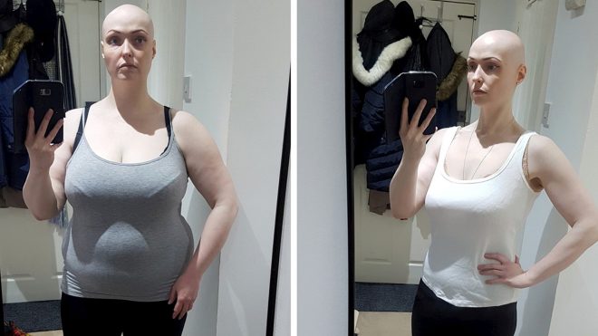 Женщина похудела на 36 килограммов, отказавшись от одной привычки (ФОТО)