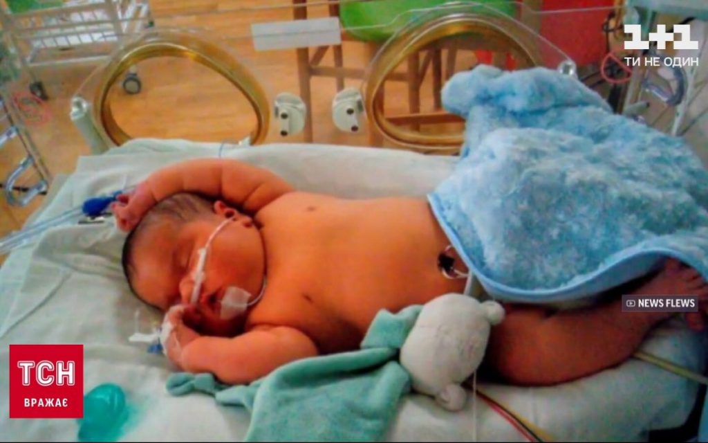 Женщина родила семикилограммового малыша (ФОТО, ВИДЕО)