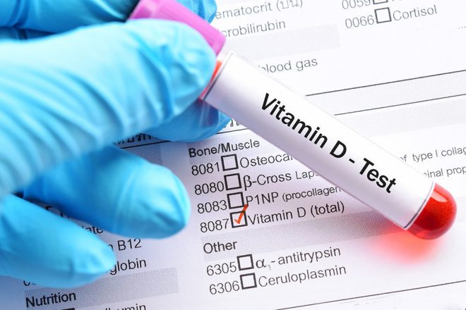 Специалисты назвали главные симптомы дефицита витамина D