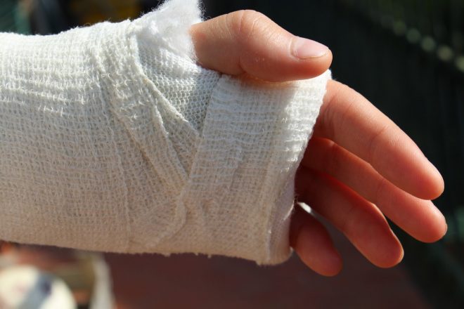 В Одессе ученица на уроке физкультуры сломала руку в двух местах (ФОТО)