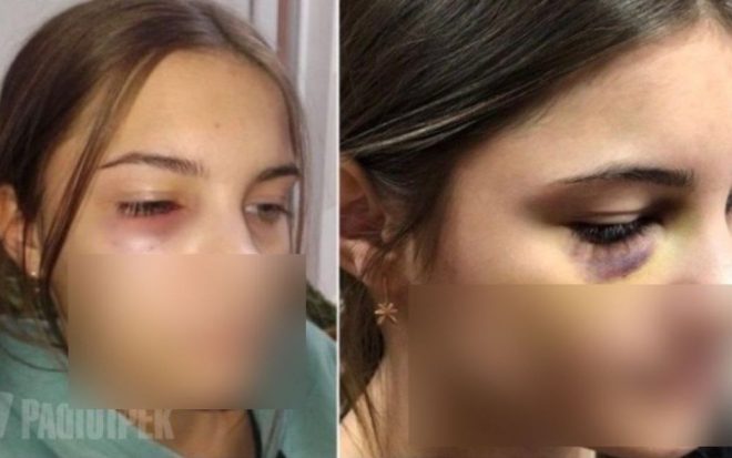 В Ровно школьник жестоко избил девушку (ФОТО)