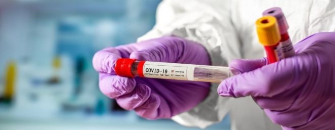 В Украине нужно ввести бесплатное COVID-тестирование &#8212; медик