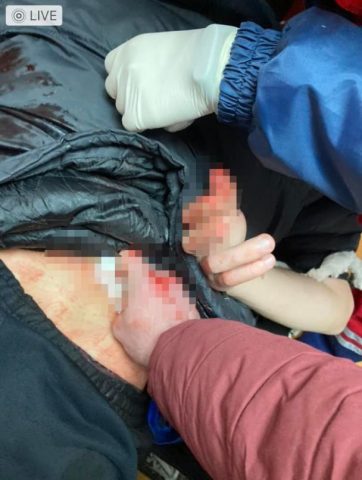 Раненый житель Львовщины чуть не погиб: медики не пустили его в больницы (ФОТО)