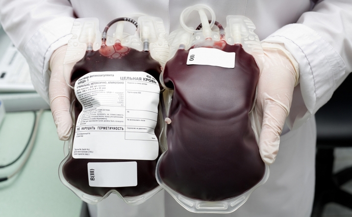 Нуждается в донорской крови: на Полтавщине жестоко избили 4-летнего ребенка