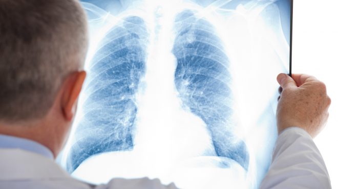 Когда одышка ведет к остановке дыхания: ответ врача