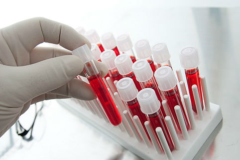 Канадские ученые научились менять группу крови