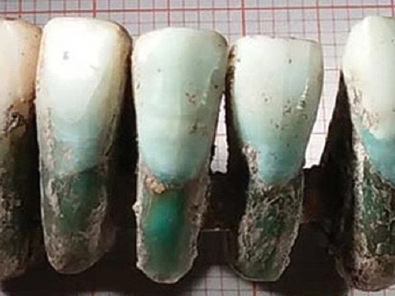 Археологи нашли зубной протез XVII века (ФОТО)