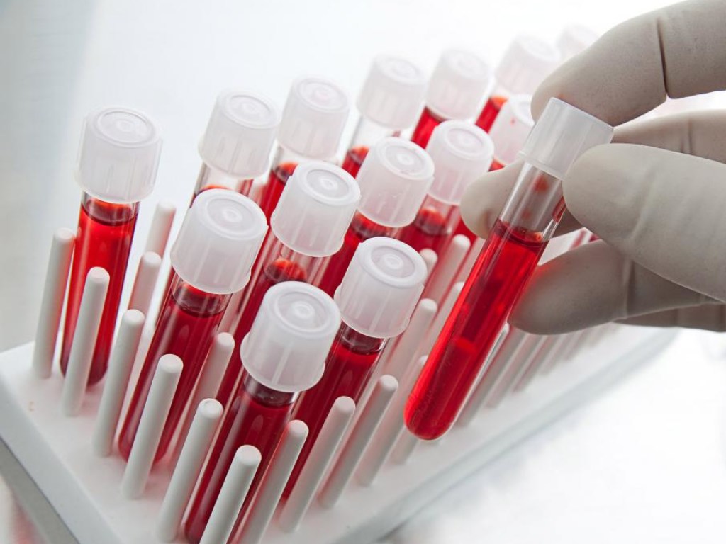 Ученые научились выявлять аутизм по анализу крови