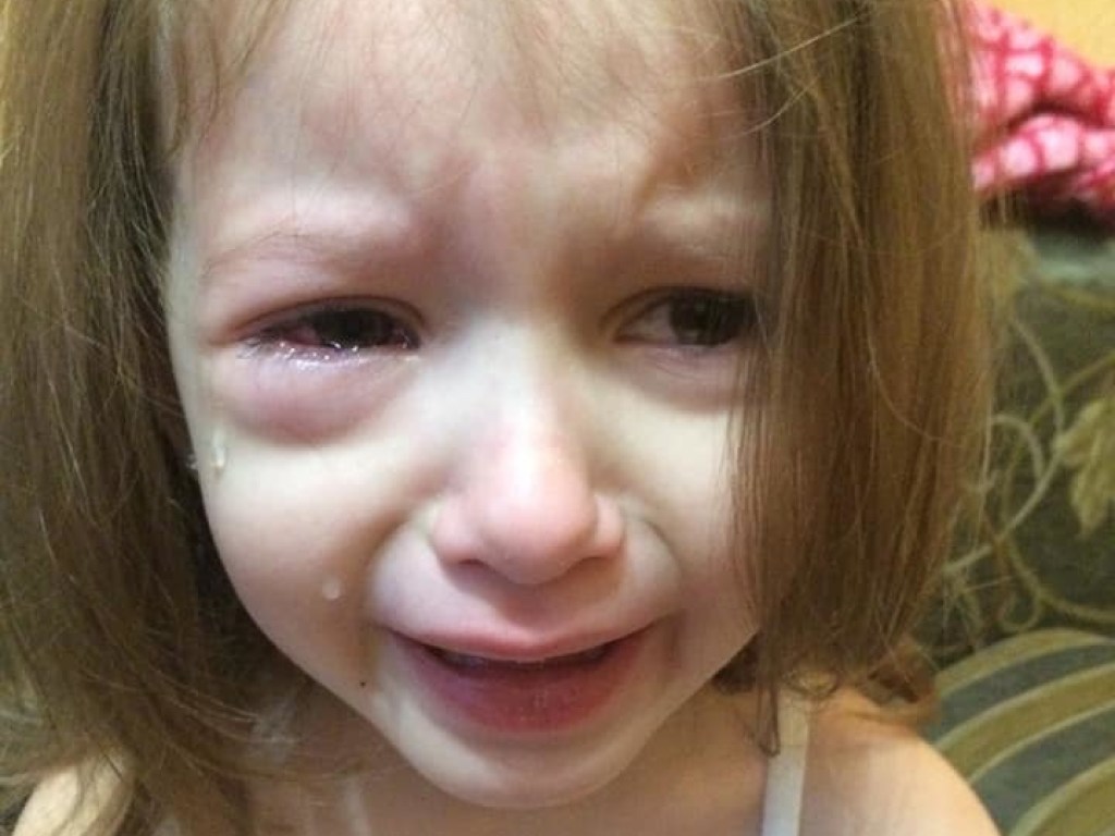 Ткнули карандашом: В детсаду Днепра девочка едва не лишилась глаза (ФОТО)