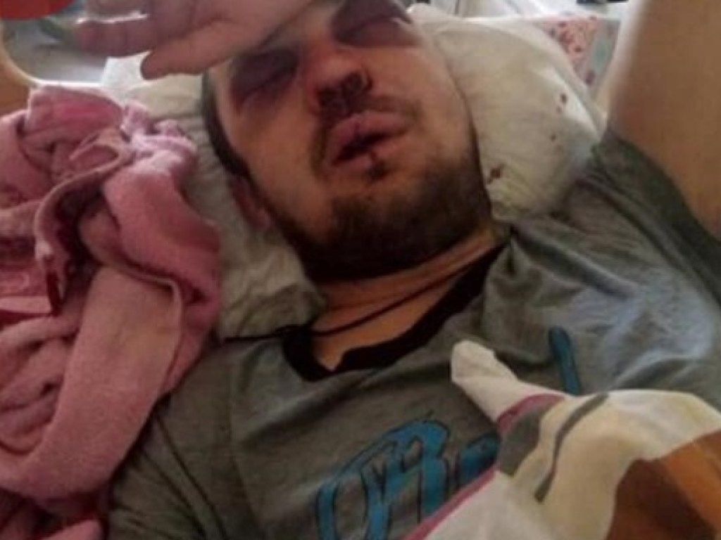 Ушиб головного мозга: водитель столичной маршрутки жестоко избил пассажира:  читать на Golos.ua