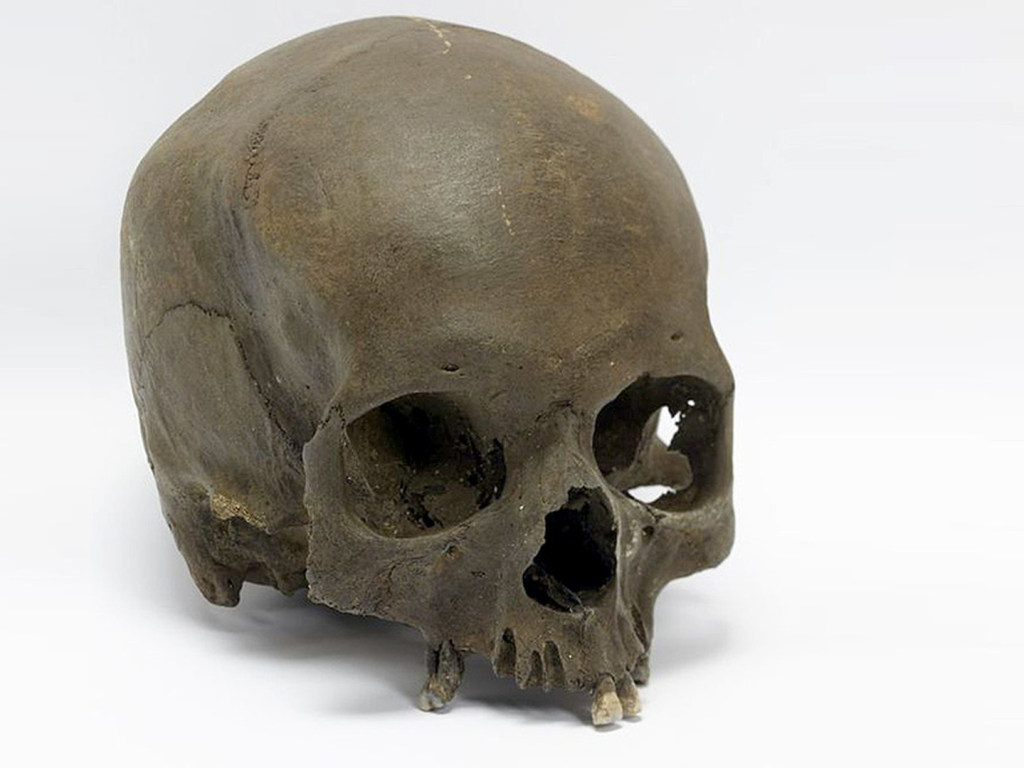 Археологи обнаружили череп странной формы (ФОТО)