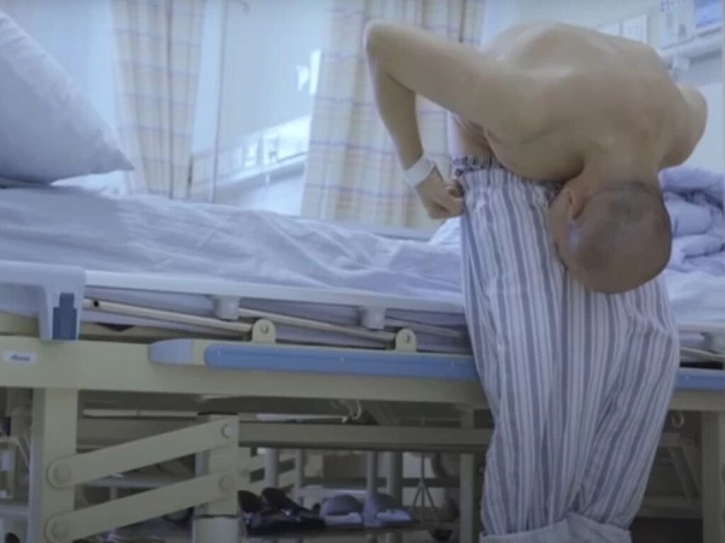 Для спасения жизни хирурги сломали мужчине позвоночник в двух местах (ФОТО)