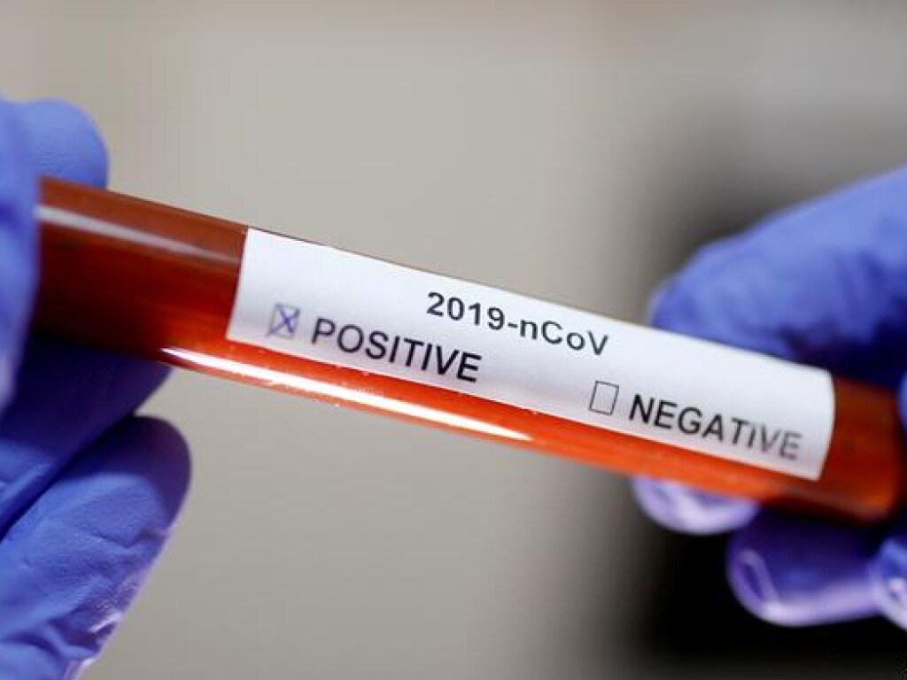 Украине необходимо наращивать тестирование на коронавирус – эксперт
